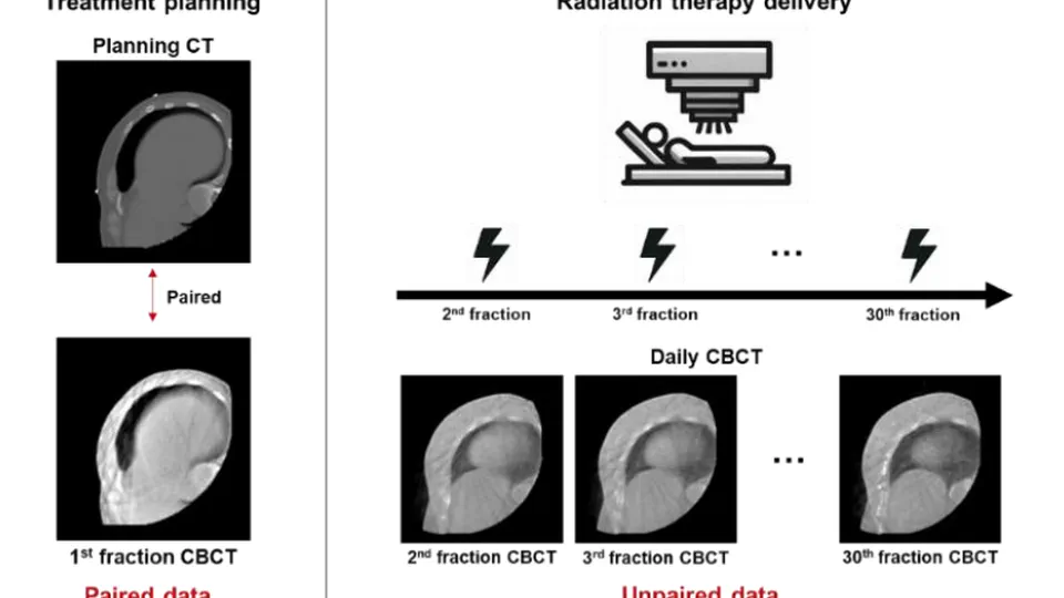 Improving Cone-Beam CT Image Quality with Knowledge Distillation-Enhanced Diffusion Model in Imbalanced Data Settings